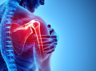Hướng dẫn cho người bị đau nhức và căng cơ